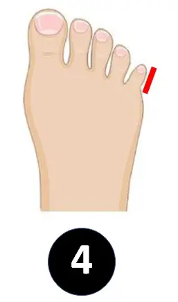 pinky-toe-personality-4