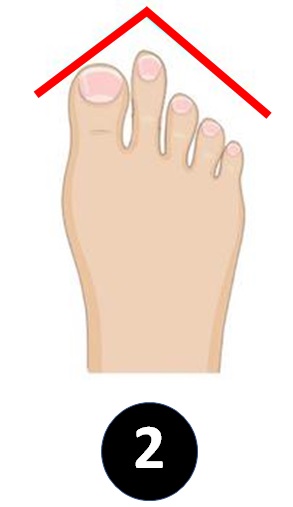 greek-toe-personality-second-toe-longer-than-big-toe-personality-2