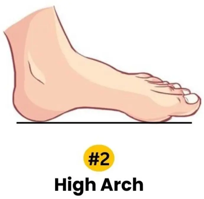 high-arch-personality-traits