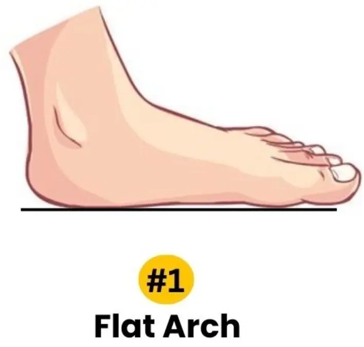 flat-arch-personality-traits