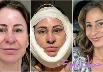 این زن به خاطر هزینه جراحی زیبایی خیابان خواب شد! 