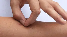 آیا کندن پوست نشان دهنده اضطراب است؟ 