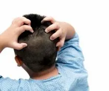 نسخه درمانی طب سنتی برای اگزما پوست سر 