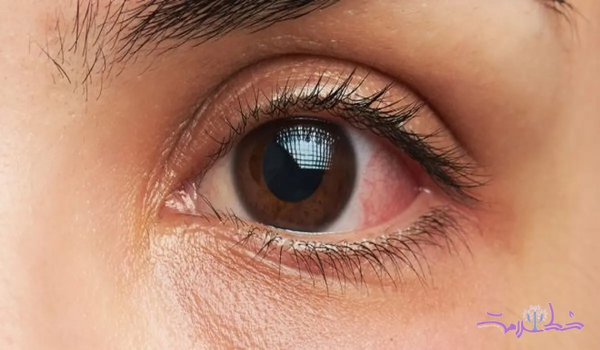 آخرین یافته حیرت انگیز در مورد امگا 3