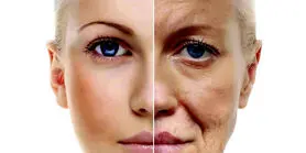 5 راه برای جلوگیری از چین و چروک هنگام خواب/ فرمول کاهش پیری پوست اعلام شد