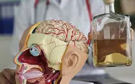 حمله الکل به مغز این سه گروه غیر قابل جبران است!