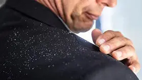 موهای خود را به این ترکیب جادویی بسپارید