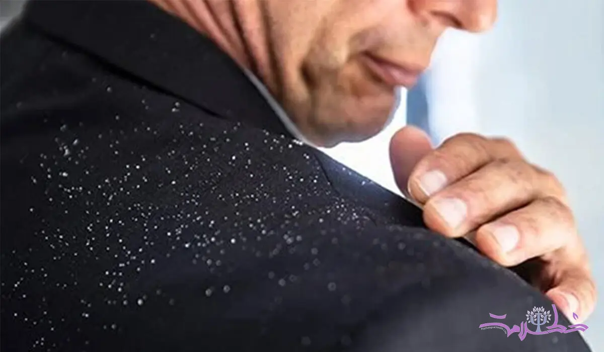 موهای خود را به این ترکیب جادویی بسپارید