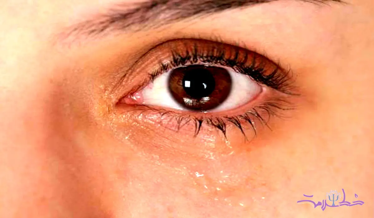 16 راهکار علمی برای جلوگیری از خشکی چشم
