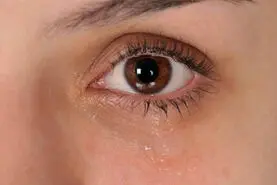 16 راهکار علمی برای جلوگیری از خشکی چشم