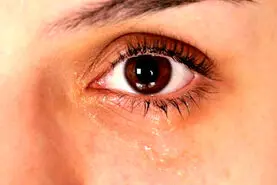 16 راهکار علمی برای جلوگیری از خشکی چشم