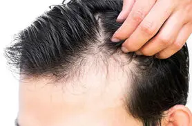 این ویتامین جلوی ریزش مو را می گیرد