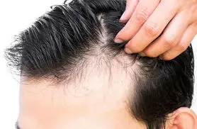این ویتامین جلوی ریزش مو را می گیرد