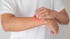با این 7 شیوه طبیعی درد و خارش اگزما را کاهش دهید