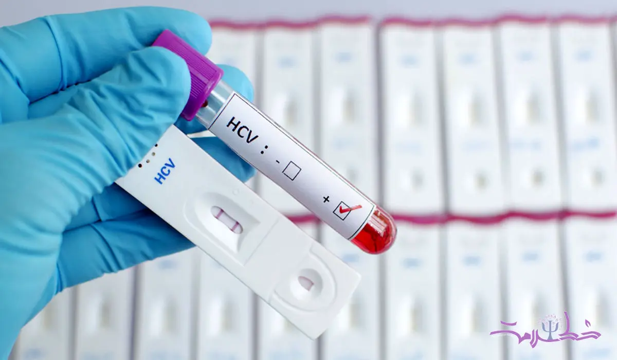 آیا ایدز (HIV ) از آغوش، بوسیدن و از سرفه یا عطسه منتقل می شود؟