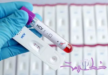 آیا ایدز (HIV ) از آغوش، بوسیدن و از سرفه یا عطسه منتقل می شود؟