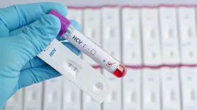 آیا ایدز (HIV ) از آغوش، بوسیدن و از سرفه یا عطسه منتقل می شود؟