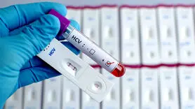 آیا ایدز (HIV ) از آغوش، بوسیدن و از سرفه یا عطسه منتقل می شود؟