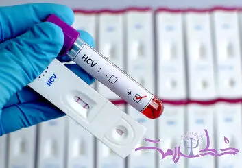 آیا ایدز (HIV ) از آغوش، بوسیدن و از سرفه یا عطسه منتقل می شود؟