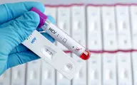 آیا ایدز (HIV ) از آغوش، بوسیدن و از سرفه یا عطسه منتقل می شود؟