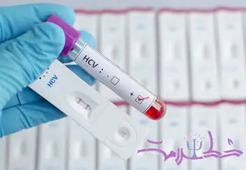آیا ایدز (HIV ) از آغوش، بوسیدن و از سرفه یا عطسه منتقل می شود؟