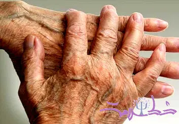 بهترین مواد غذایی برای کاهش درد و مدیریت روماتیسم