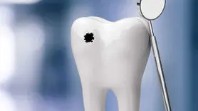 کاهش پوسیدگی دندان با تکنیک های طب سنتی، بدون هزینه و خانگی