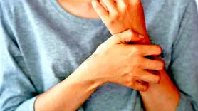 فیلم/ چرا برخی افراد پوست شان بیشتر می خارد+انواع و علل خارش پوست