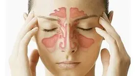 سینوزیت را با سرماخوردگی اشتباه نگیرید + تشخیص ، علل و درمان خانگی