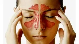 سینوزیت را با سرماخوردگی اشتباه نگیرید + تشخیص ، علل و درمان خانگی