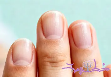  یک نکته مهم در مورد سلامتی که فقط ناخن  ها نشان می دهند!