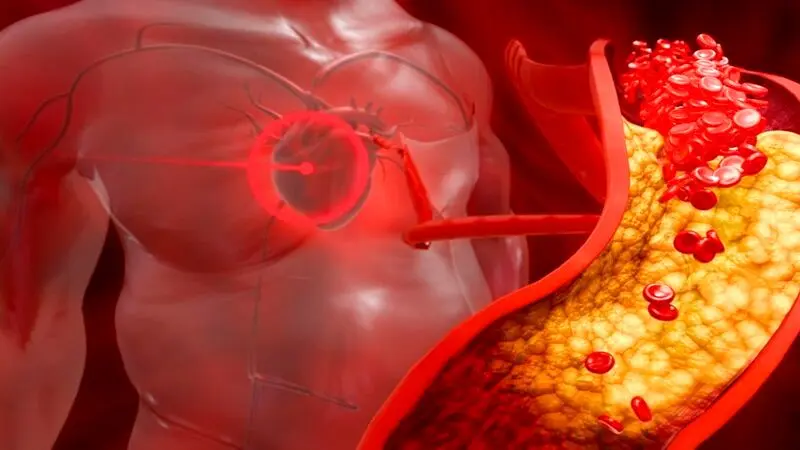 هر آنچه باید از علائم چربی خون بالا بدانید + روش های درمان