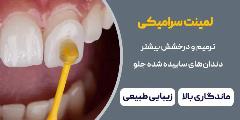 درمان ساییدگی دندان جلو با لمینت سرامیکی