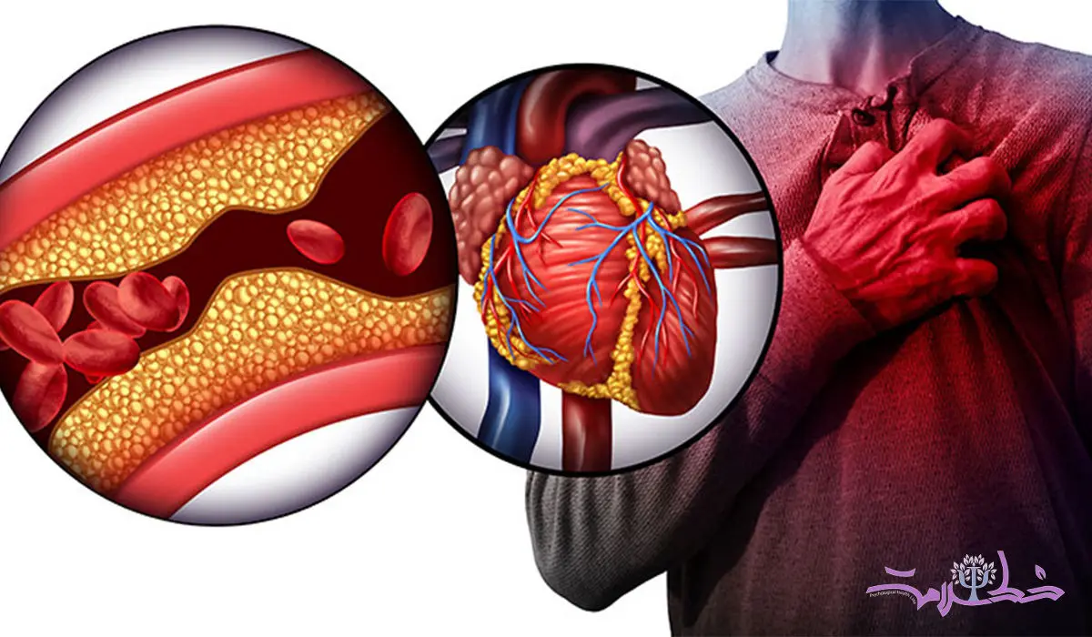 علائم اولیه انسداد قلب چیست؟ / روش های درمان انسداد قلبی