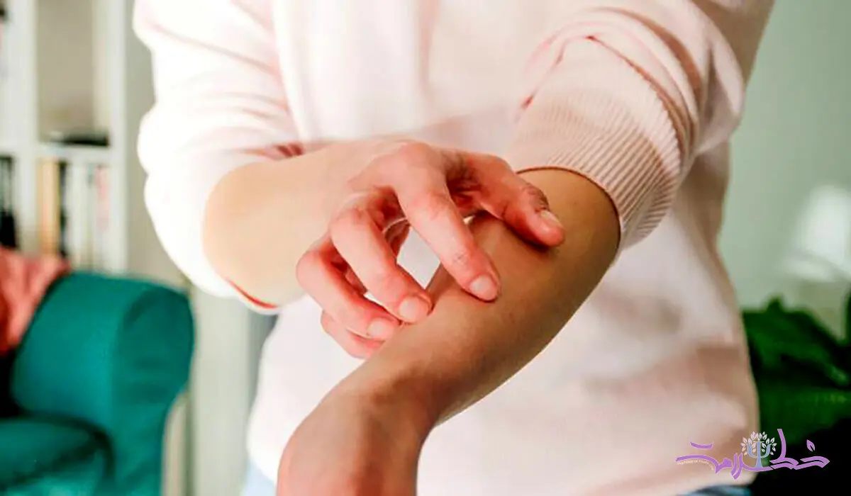 چگونه علائم آلرژی و خارش موضعی را در خانه کم کنید!