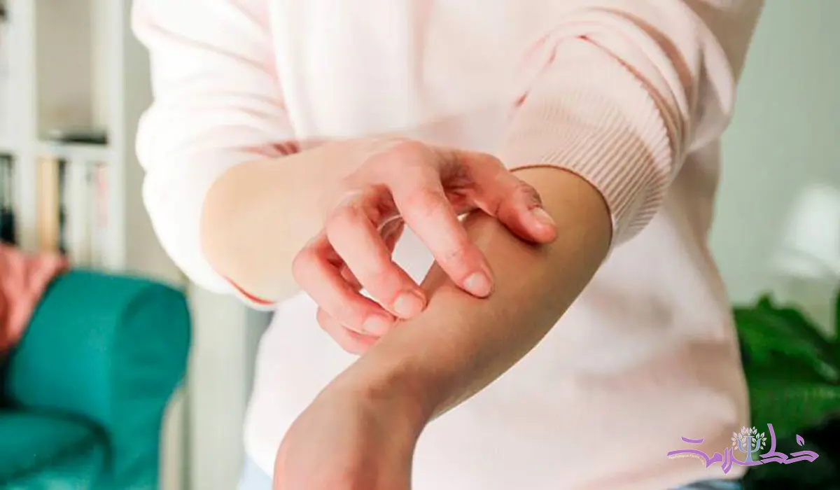 چگونه علائم آلرژی و خارش موضعی را در خانه کم کنید!