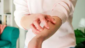 چگونه علائم آلرژی و خارش موضعی را در خانه کم کنید!