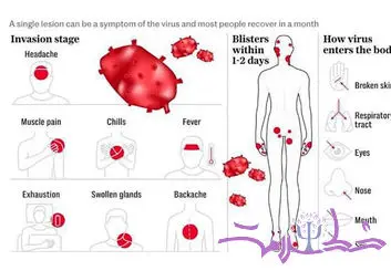 خلاصه و کامل درباره ویروس Mpox یا آبله میمون بدانید