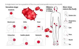 خلاصه و کامل درباره ویروس Mpox یا آبله میمون بدانید