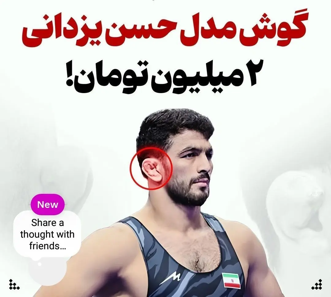 عکس: گوش مدل حسن یزدانی ۲ میلیون تومان!