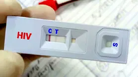 درمان رایگان ایدز؛ کنترل ویروس HIV با دسترسی به خدمات درمانی