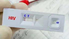 درمان رایگان ایدز؛ کنترل ویروس HIV با دسترسی به خدمات درمانی