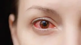 علل ایجاد التهاب قرنیه
