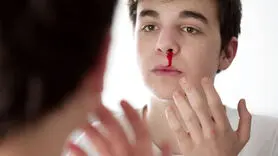 درمان های خانگی برای جلوگیری از خون دماغ شدن