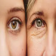 این ماده غذایی سن تان را معکوس می کند/ غافل نشوید