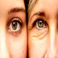 این ماده غذایی سن تان را معکوس می کند/ غافل نشوید