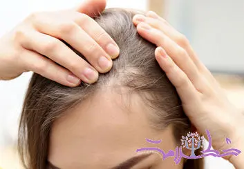 طرز تهیه چای مخصوص برای رشد سریع و انفجاری موهای سر