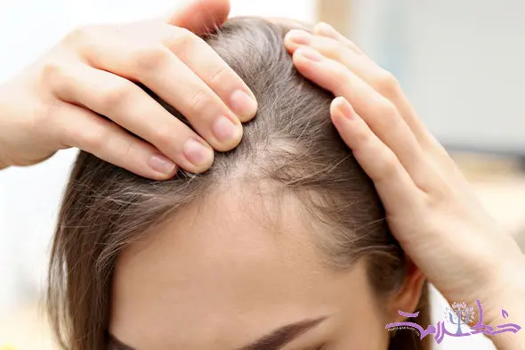 طرز تهیه چای مخصوص برای رشد سریع و انفجاری موهای سر