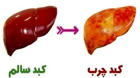 نشانه‌های چرب شدن کبد 