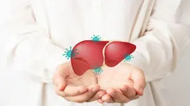 علل و علائم و عوارض هپاتیت الکلی 
